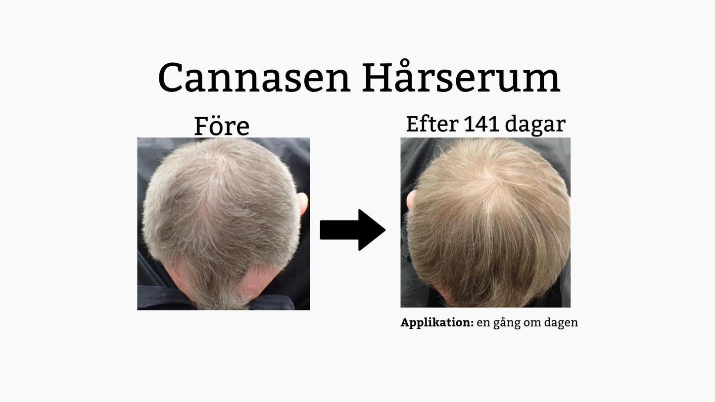 Cannasen Hårserum mot håravfall (4 x 20 ml)