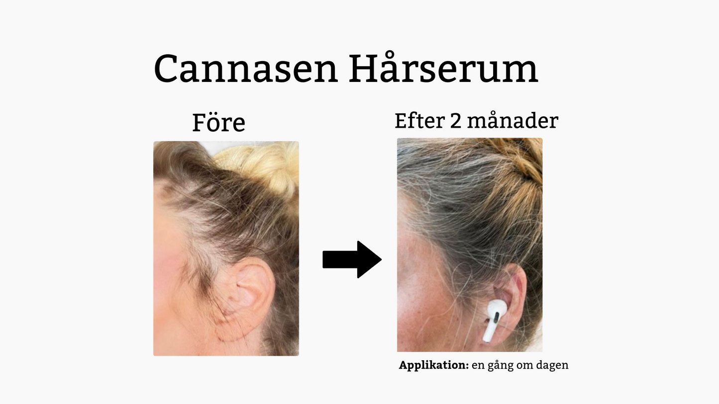 Cannasen Hårserum mot håravfall (4 x 20 ml)