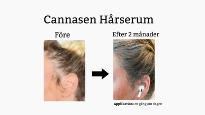 Cannasen Hårserum mot håravfall (4 x 20 ml)