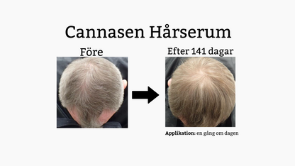 Cannasen Hårserum mot håravfall (4 x 20 ml)